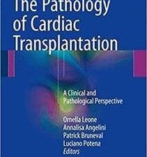 The Pathology of Cardiac Transplantation: A clinical and pathological perspective