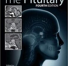 the pituitary 4th edition