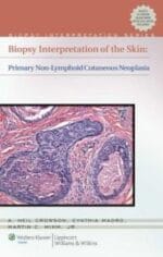 Biopsy Interpretation of the Skin: Primary Non-lymphoid Neoplasms of the Skin
