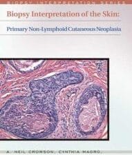 Biopsy Interpretation of the Skin: Primary Non-lymphoid Neoplasms of the Skin