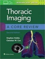 Thoracic Imaging: A Core Review 2nd Edition