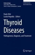 Thyroid Diseases: Pathogenesis, Diagnosis, and Treatment