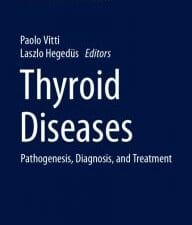 Thyroid Diseases: Pathogenesis, Diagnosis, and Treatment