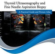 thyroid ultrasonography and fine needle aspiration biopsy: a practical guide and picture atlas
