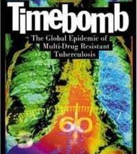 Timebomb:The Global Epidemic of Multi-Drug Resistant Tuberculosis