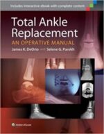 total ankle replacement: an operative manual first edition