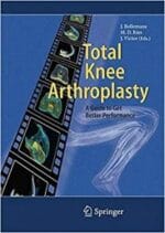 total knee arthroplasty