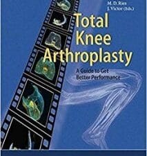 total knee arthroplasty