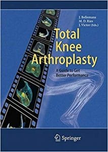 total knee arthroplasty