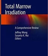 total marrow irradiation: a comprehensive review