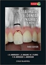 Traumatic Dental Injuries: A Manual