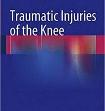 traumatic injuries of the knee