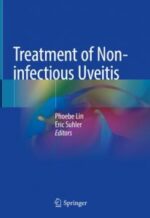 treatment of non infectious uveitis