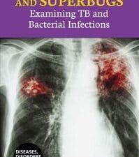 tuberculosis and superbugs: examining tb and bacterial infections