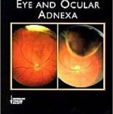 tumors of the eye and ocular adnexa