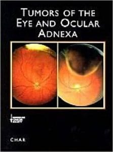 tumors of the eye and ocular adnexa