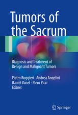 tumors of the sacrum: diagnosis and treatment of benign and malignant tumors