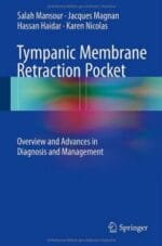 tympanic membrane retraction pocket: overview and advances in diagnosis and management