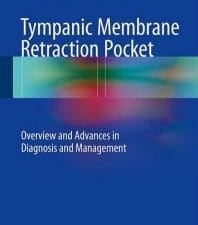 tympanic membrane retraction pocket: overview and advances in diagnosis and management
