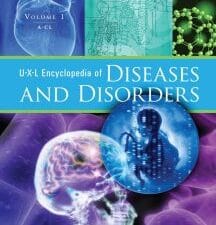 uxl encyclopedia of diseases and disorders