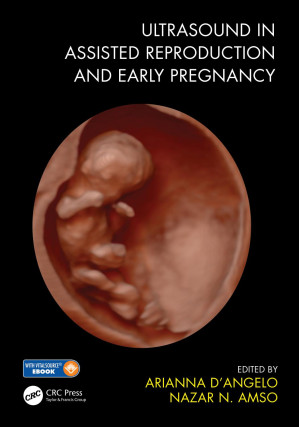 ultrasound in assisted reproduction and early pregnancy 1st edition