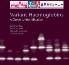 variant haemoglobins: a guide to identification