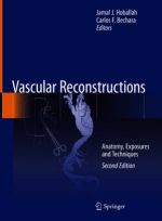vascular reconstructions: anatomy, exposures and techniques