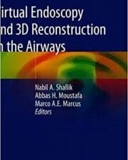 virtual endoscopy and 3d reconstruction in the airways