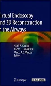 virtual endoscopy and 3d reconstruction in the airways
