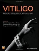 Vitiligo: Medical and Surgical Managmement