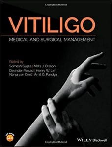 Vitiligo: Medical and Surgical Managmement