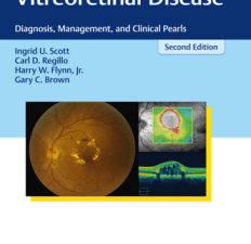 vitreoretinal disease : diagnosis, management, and clinical pearls, second edition