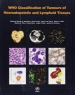 who classification of tumours of hematopoietic and lymphoid tissues 4th edition