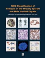 who classification of tumours of the urinary system and male genital organs
