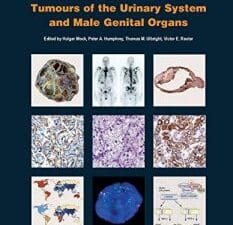 who classification of tumours of the urinary system and male genital organs