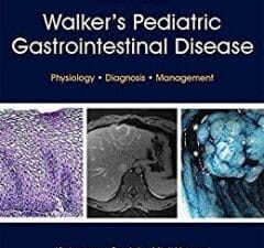 walker’s pediatric gastrointestinal disease: physiology, diagnosis, management