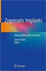 zygomatic implants: optimization and innovation