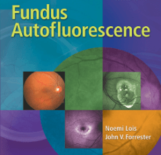 fundus autofluorescence, second edition