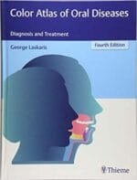 Color Atlas of Oral Diseases: Diagnosis and Treatment (4th Edition)