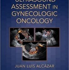ultrasound assessment in gynecologic oncology 1st edition