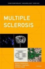 multiple sclerosis (contemporary neurology series, 84) illustrated edition