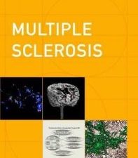 multiple sclerosis (contemporary neurology series, 84) illustrated edition