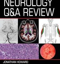 neurology q&a review 1st edition