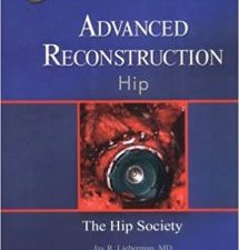 advanced reconstruction hip (american academy of orthopaedic surgeons (aaos)) (advanced reconstruction s) 1st edition