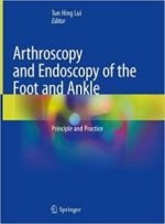 arthroscopy and endoscopy of the foot and ankle: principle and practice