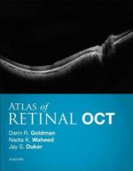atlas of retinal oct: optical coherence tomography 1st edition