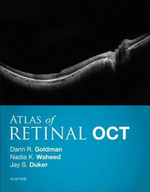 atlas of retinal oct: optical coherence tomography 1st edition