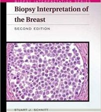 biopsy interpretation of the breast (biopsy interpretation series) 2nd edition