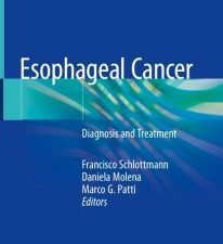 esophageal cancer: diagnosis and treatment