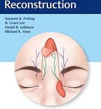 eyelid reconstruction